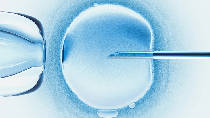 Thụ tinh trong ống nghiệm (IVF) tự động sẽ tiêm tinh trùng vào bào tương noãn (ICSI), thường được sử dụng trong các trường hợp vô sinh nam - Ảnh: KTSDESIGN/Getty Images