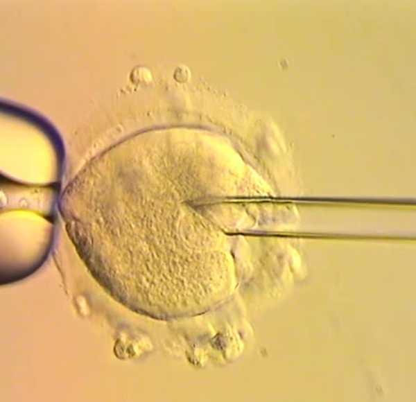 Đột phá IVF ở Anh: Mẹ có đột biến trong ti thể, 8 em bé vẫn chào đời khỏe mạnh
